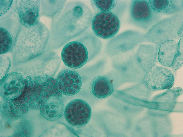 Fern Gametophyte Slides - Ferngametophyte 02 400X